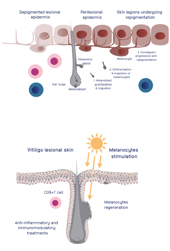 Interventions_And_Repigmentation_Mobile