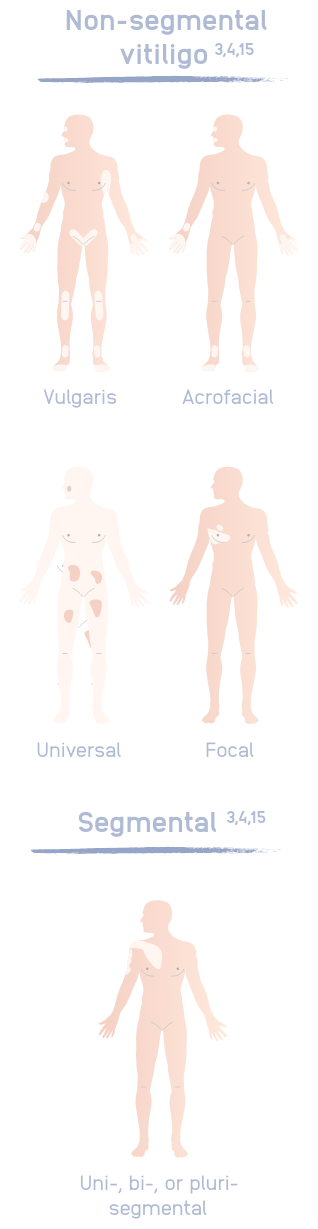 2.0_What_Is_Vitiligo_Mobile.png