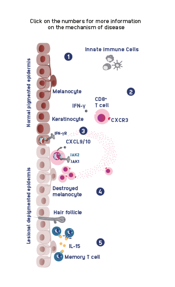 INT2106_Inctye_Vitiligo_Website_Graphics_R3V4_Immunopathology_Mobile.png