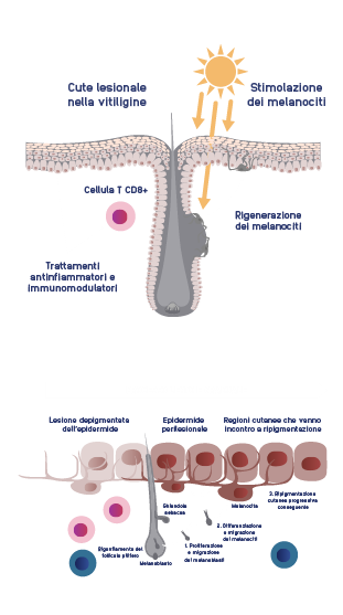 Interventions_And_Repigmentation_Mobile.png