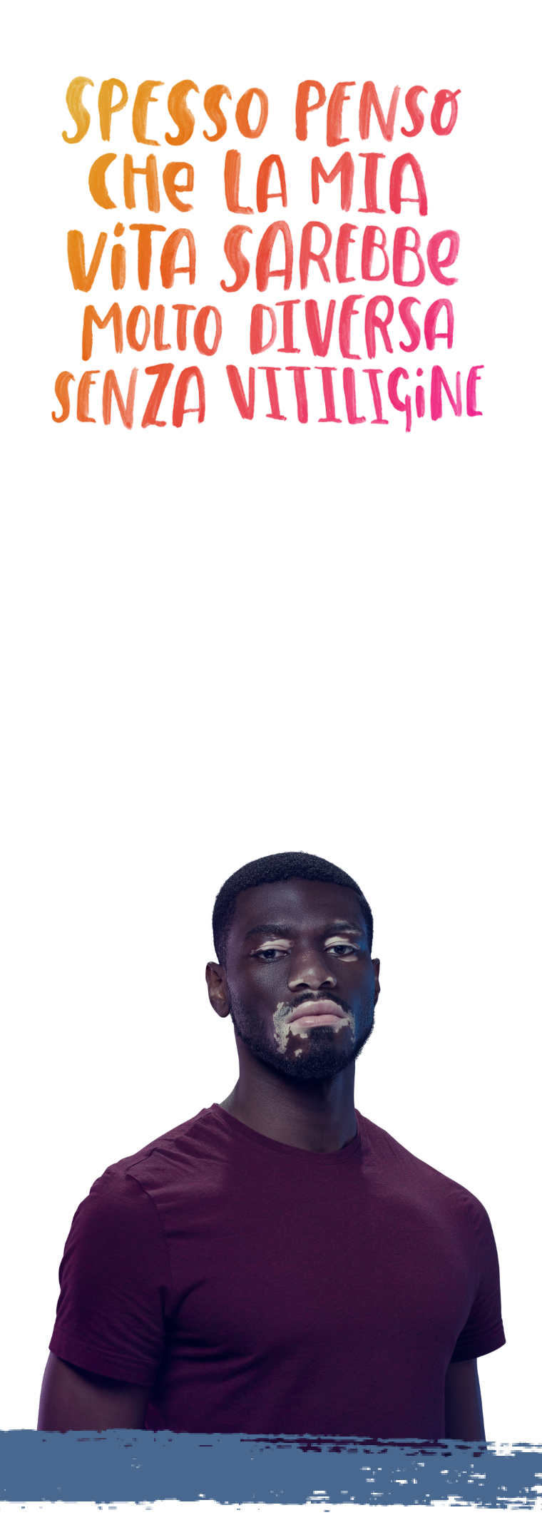 what_is_Vitiligo_banner-mobile.png
