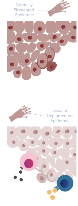 skin_depigmentation_mobile.png
