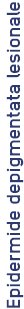 Lesional_depigmented_epidermis